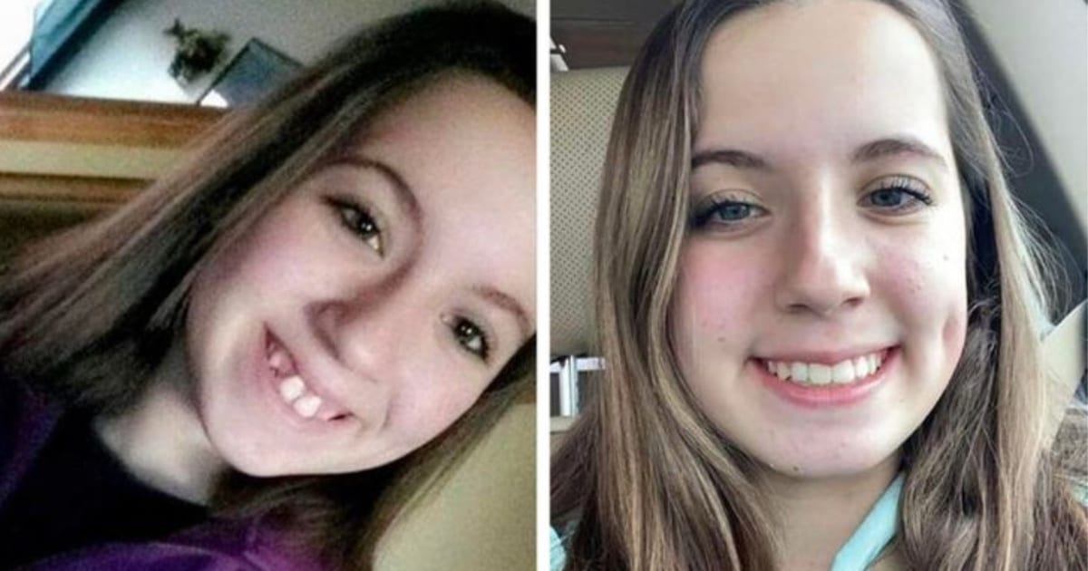 10 Dental Transformations That Are Truly Stunning 